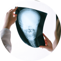 brain-injuries