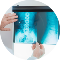 failure-to-diagnose-misdiagnose