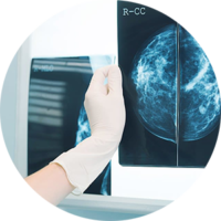 missed-breast-cancer-diagnosis-banner